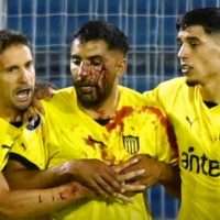 Αργεντινή: Επίθεση με πέτρα στο πρόσωπο σε παίχτη, από οπαδό
